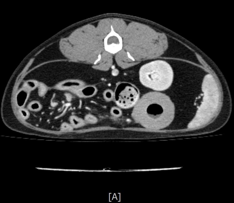반려동물 CT 촬영 예시 이미지 1