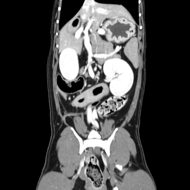 반려동물 CT 촬영 예시 이미지 2