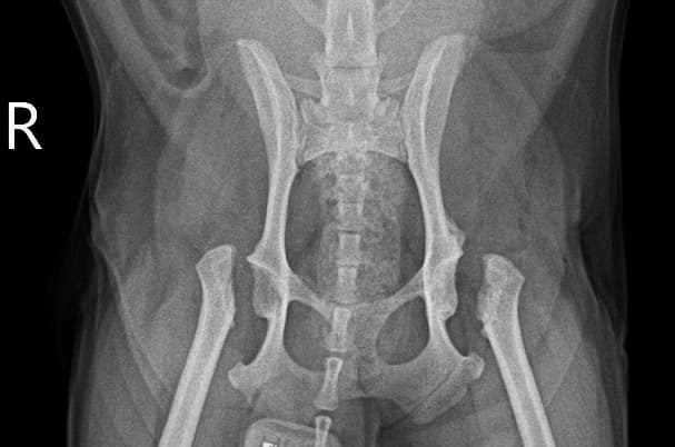 고관절 진단 및 치료 예시 이미지 2