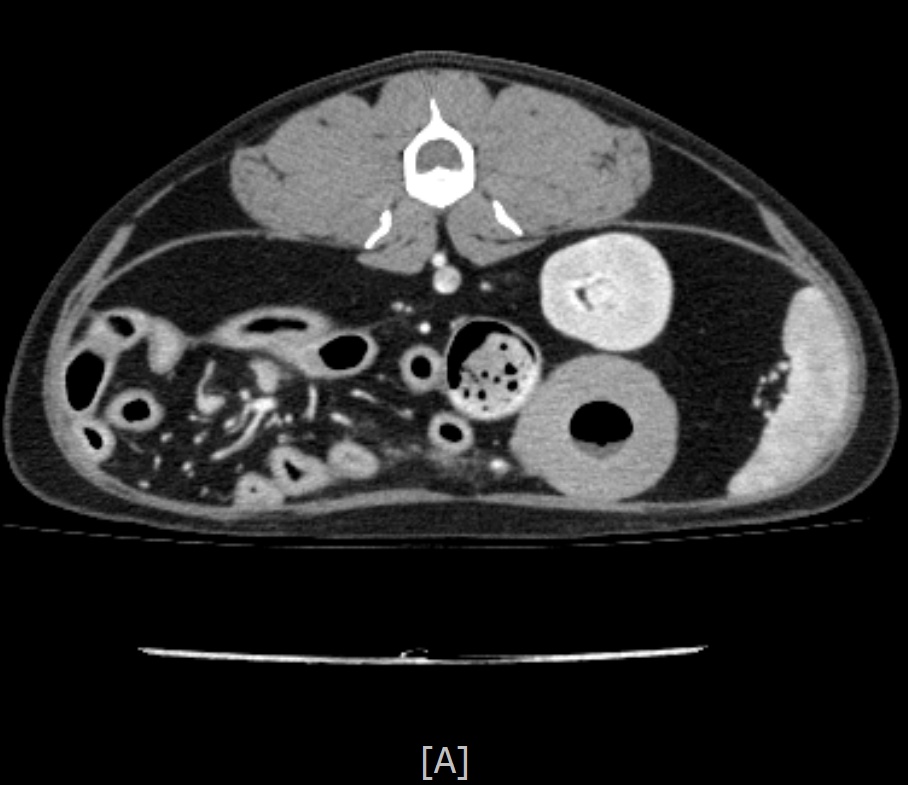 ct image