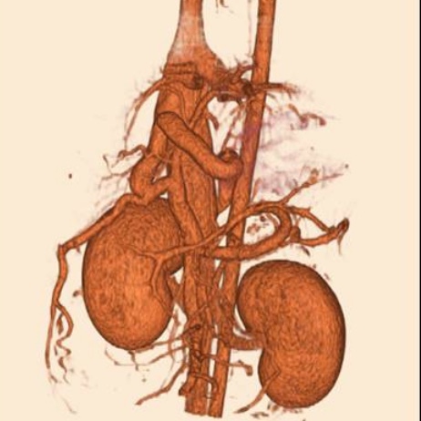 ct image