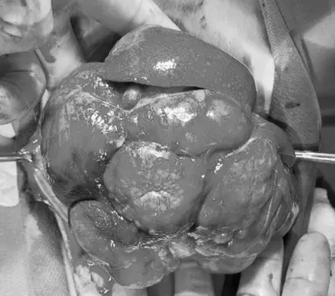 ct image